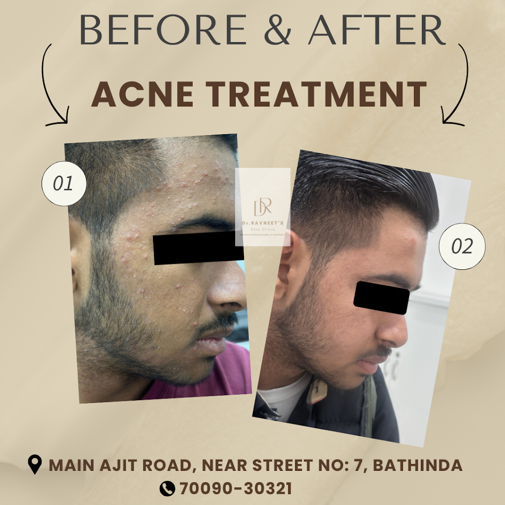 Treatment Result